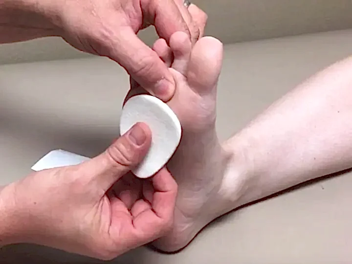 kayak ve morton nöroma